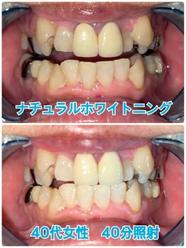 プラチナムビューティー 川口駅前店(PLATINUM BEAUTY)/コーティング機能によりツヤも