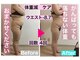 マッチ(much)の写真