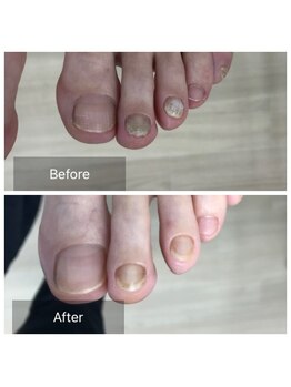 ドクターネイル爪革命 北千住店/トータルフットケア