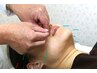 キャッシュ支払い限定１００円OFF！！　美容鍼灸コースの方へ