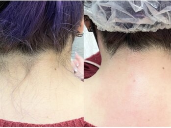 ラニブロウ(Lani brow)/お顔のくすみが気になる方♪