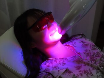 ホワイトニングミース 北千住店(MYS)/照射時間エリア1ホワイトニング