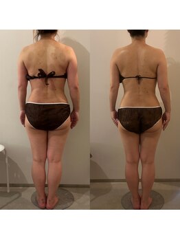 ラナ 京都西院店(Lana)/全身の浮腫みスッキリ！