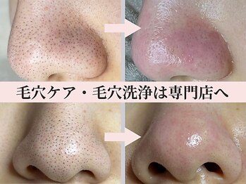 ティーツリー 名古屋 桜山(Tea Tree)/【毛穴ケア・毛穴洗浄】