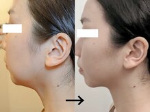 ボディーワークスナビ(Body Works Navi)/フェイスラインから印象を変える