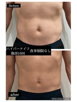 ナムズ(Nams)/ビフォーアフター