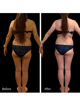 クールヴィラ(Cool Villa)/