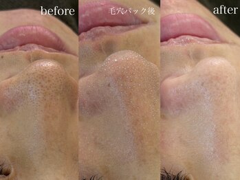 テオリア(TEORIA)/