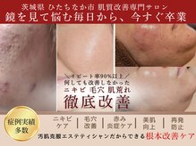 ユウビジン(YOU美人)