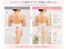 ベルビー エルエル岡崎店/挙式前3ヶ月集中ケア