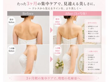 ベルビー エルエル岡崎店/挙式前3ヶ月集中ケア