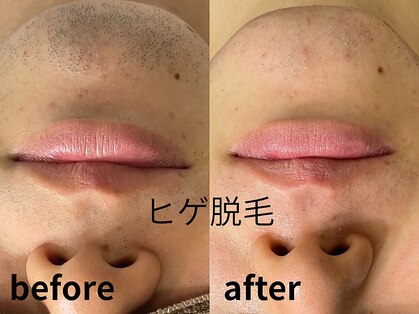 ウルル(ULuLu)の写真