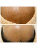 《6月限定》ツヤ肌・美肌◎フェイシャルWAX/デコルテヘッドマッサージ付