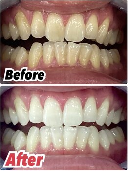 ホワイトニングスタイル 柏店/お得な回数券有り★