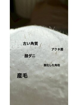 ラダ(RADA)/フェイスワックス/アノン