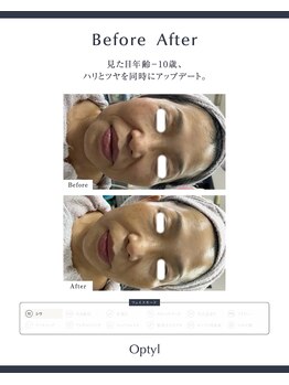 リリードボーテ 高槻店(LILY DE BEAUTE)/Optyk使用