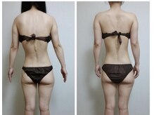 エメ(Aimer)/【30代リバイセルボディ結果☆】