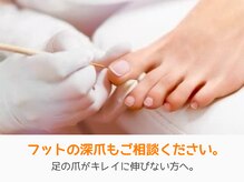 レアム/足の爪の深爪をどうにかしたい。