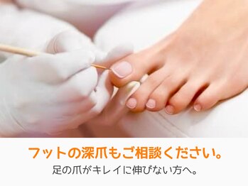レアム/足の爪の深爪をどうにかしたい。