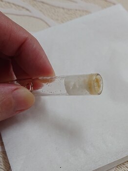 エステティックサロンアネラ(Anela)/吸引した皮脂汚れに驚き！