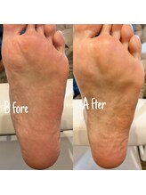 リンダテール バイ アンディグレス(Linda Tail by, Andygless)/＊by &nbsp;kayo＊