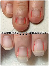 スマイルニコ(smile nico)/爪の側面を伸ばす事が大切