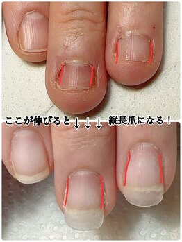 スマイルニコ(smile nico)/爪の側面を伸ばす事が大切