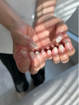 ラモネイル(RamoNAIL)/