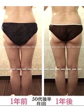 バービーホリック(barbie holic)/リラクゼーション希望　１年後