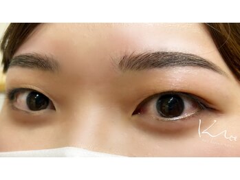 クレー(Klee)/アイブロウリフト