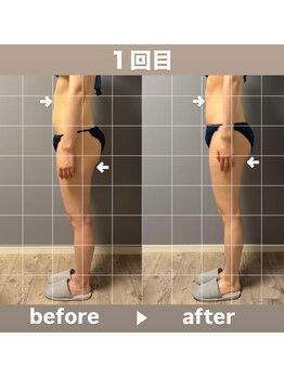 メゾン ド クロエ(Maison de Chloe)/CHLOE式パーソナル痩身