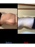 お身体引き締めたい必見！次世代EMSで寝たまま30分で筋トレ×１０回券