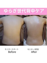 マッサージ整体 ピーカン/自分では行き届かない背中ケア