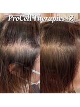 アイスブルー(Ice blue)/プロセルセラピーズBefore/After