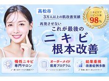 アンジェロ