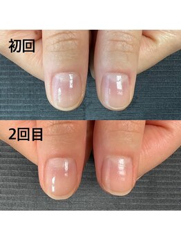 ピュアティネイル(purity nail)/最強ネイルケア