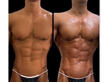 ジーニー(Genie)/ハイパーナイフで魅せる身体