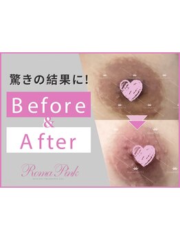 バストラインを整えたい