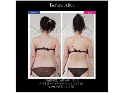 エキュレ ジャーニー トゥ マイ トータル ビューティー(equrer)の写真