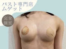 ムゲット