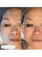 キュレイテッドスキン(CURATED SKIN)