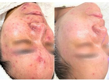 ウォナ(WONA)/【お客様症例】