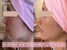 エステティックサロン アールグレー