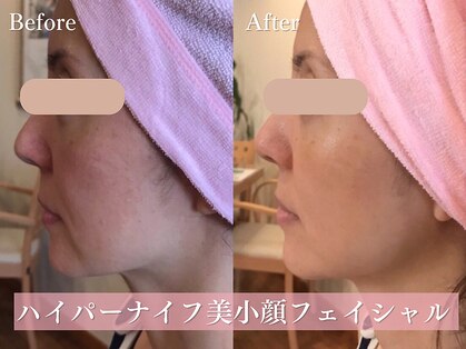 エステティックサロン アールグレーの写真