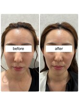 ワンダーウォール 福岡城南店(WONDER WALL)/RED SHOT