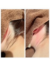 A&A 小山VAL店/うなじWAX