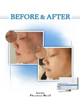ドルチェビューティーサロン 戸塚安行店(Dolce Beauty Salon)/ダクトピール