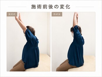 テラス 千葉(TERAS)/肩こりで来店/40代女性