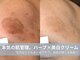 ラシック 加古川店(La chic.)の写真/ハーブで頑固なシミを狙い撃ち美肌育成×最新プラズマでシワに潤い注入！欲張りＷエイジングケア★