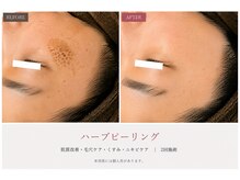 イル 名取店(iru)の雰囲気（ハーブピーリング/毛穴/フェイシャル/シミ/リフトアップ/小顔）